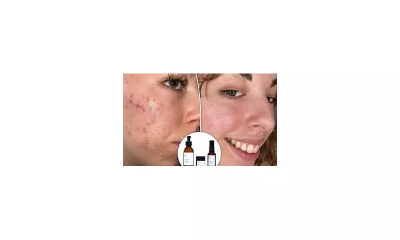 47 Skin's Blemish-Busting Miracle: Get Flawless Skin Fast with This Game-Changing Sale!