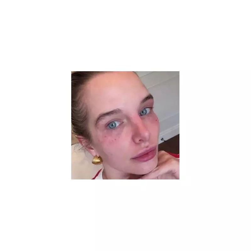 Coronation Street Star Helen Flanagan Stuns Fans with Jaw-Dropping Bikini Snap