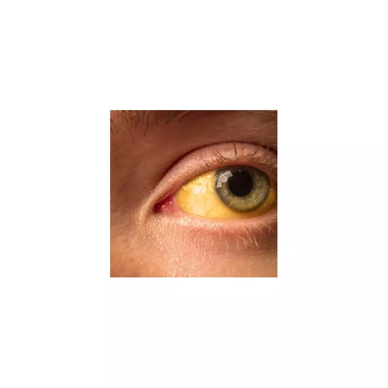 Dark Urine and Fatigue? The Little-Known Illness You Might Be Ignoring