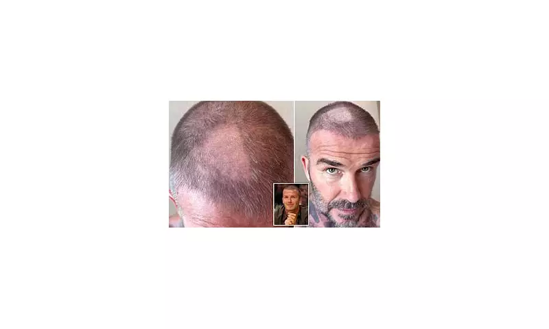 David Beckham's DIY Haircut Disaster Leaves Him with a Shocking Bald Patch – Victoria Admits 'It Looks Terrible'