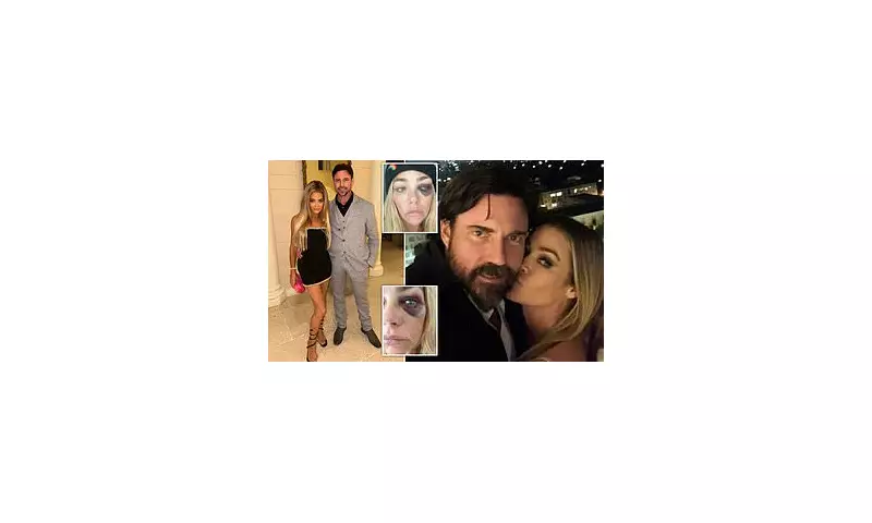 Denise Richards' Shocking Black Eye Sparks Divorce Drama with Aaron Phypers