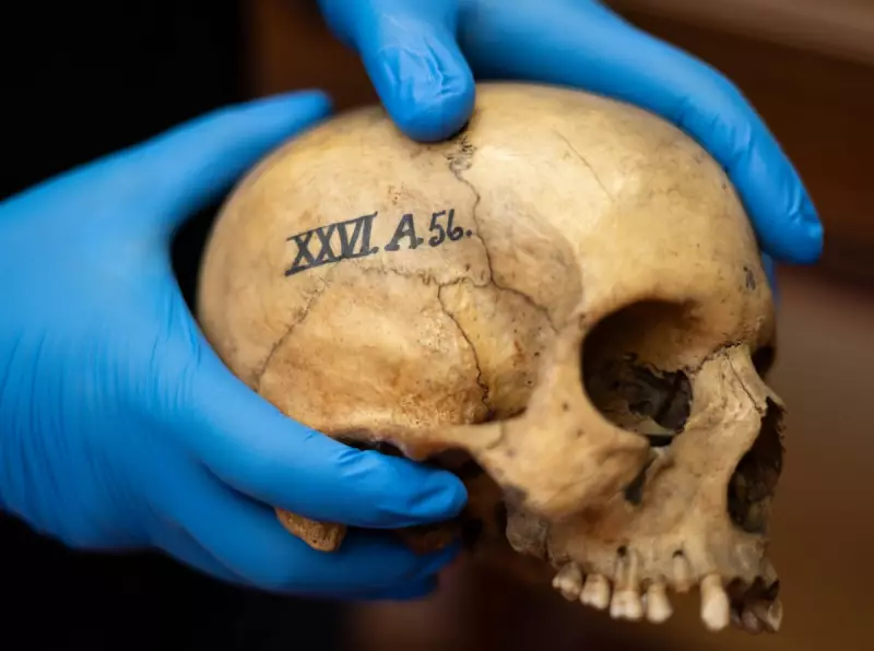Edinburgh University's Skull Room: Unpacking Its Troubled Past with Phrenology