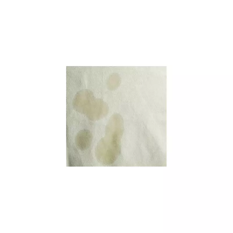 How to Remove Stubborn Sun Cream Stains from Clothes – Expert Tips Revealed