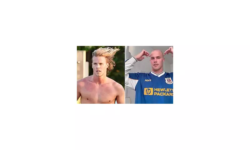 Jett Kenny, 31, Opens Up About Hair Loss and Considering a Turkish Hair Transplant