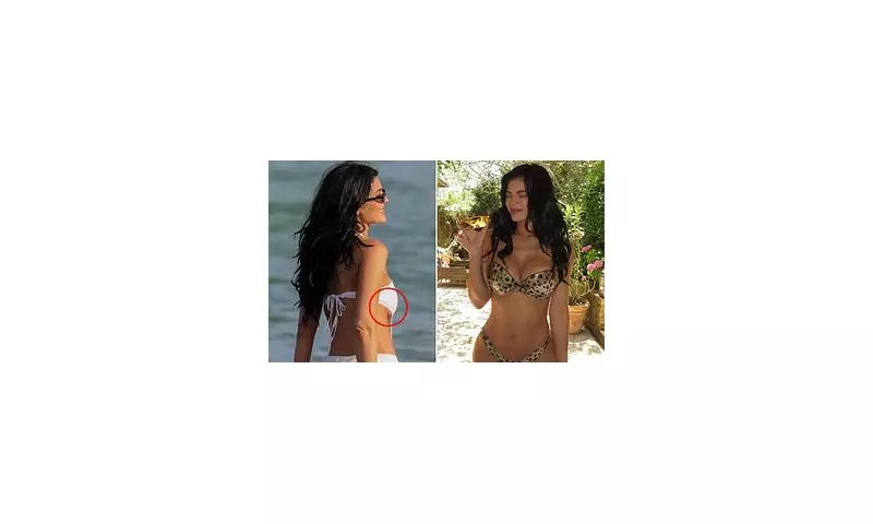 Kylie Jenner's Boob Job Secrets Revealed: Plastic Surgeon Exposes the Truth About Scarring