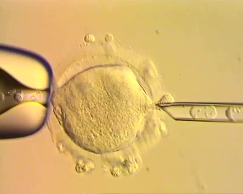 Mitochondrial Donation IVF: A Cautious Leap Forward in Genetic Medicine