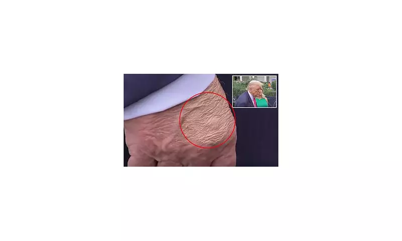 Mysterious Marks on Donald Trump's Hand Spark Health Concerns Among Experts