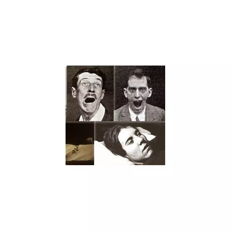 Mystery Illness Strikes: Patients Left Unable to Speak or Walk – What We Know So Far