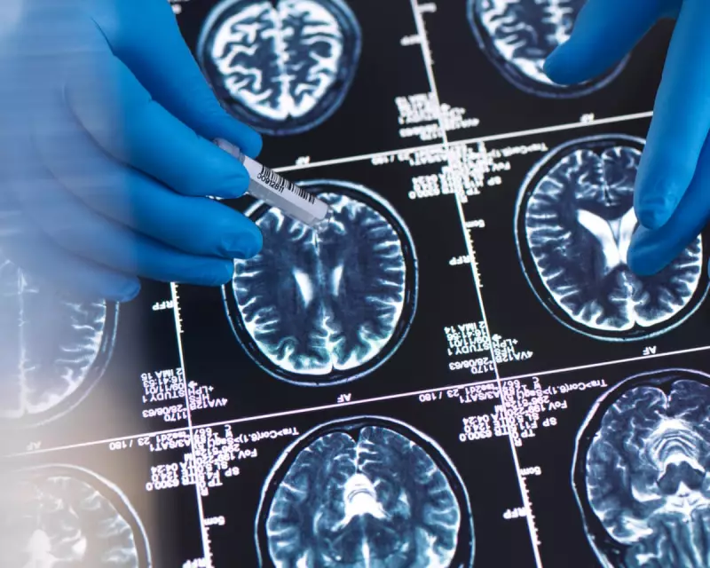 Optimists' Brains Light Up Similarly When Imagining the Future, Scans Reveal