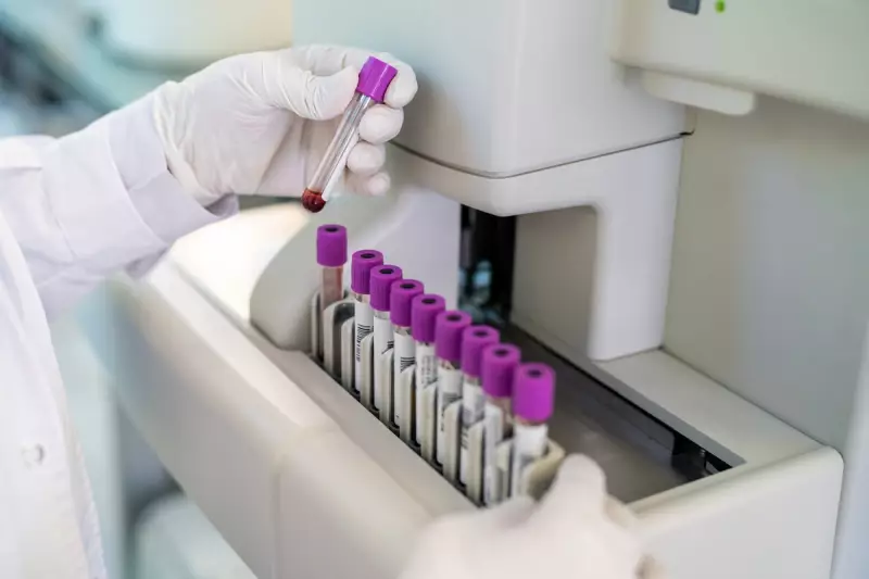 Revolutionary Blood Test Could Detect Cancer Before Symptoms Appear, Trial Shows