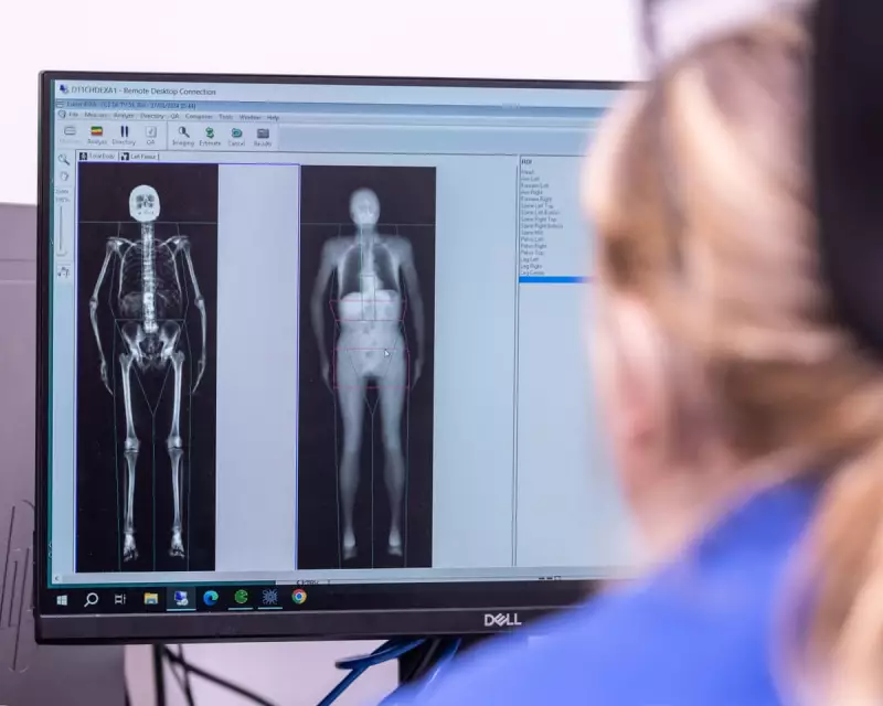 Revolutionary Full-Body Scans Unveil Hidden Diseases in UK Biobank Study