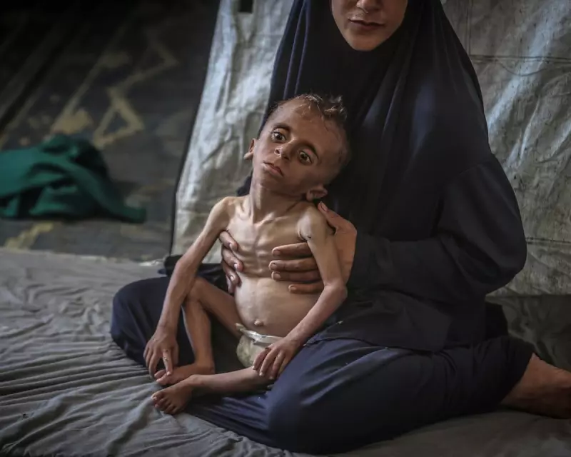 Severe Child Malnutrition in Gaza Triples in Just Two Weeks, Warns MSF