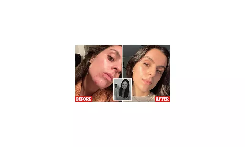 The Best Hormonal Contraceptive Pill for Acne: Aegles Supplement Review