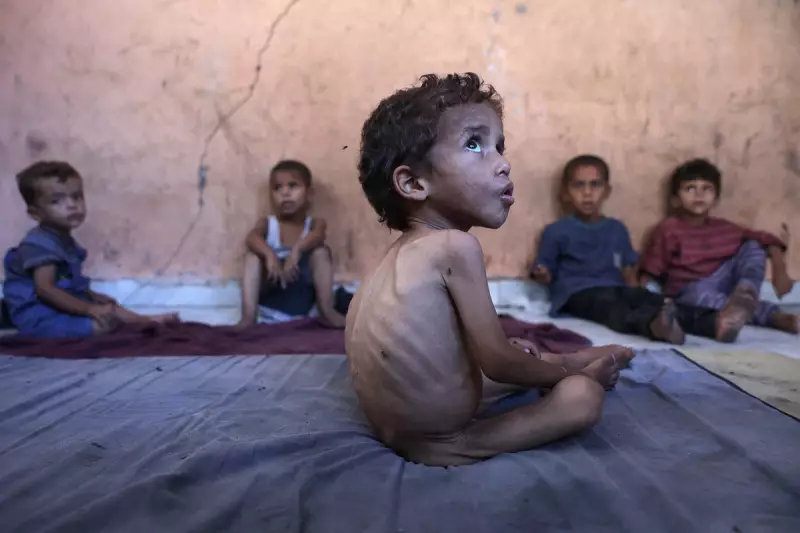 UN Warns of Catastrophic Malnutrition Crisis Among Gaza's Children
