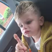 Beware the UK's Most Dangerous Plant: Giant Hogweed Leaves Can Cause Severe Burns