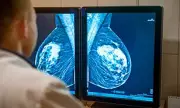 Breakthrough Blood Test Could Predict Breast Cancer Recurrence Years in Advance