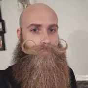 British Man Bullied for Facial Hair Since Age 12 Finally Shaves After Years of Torment