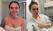 Danielle Lloyd's Stunning Skin Transformation After Skin Cancer Scare