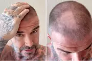 David Beckham's DIY Haircut Mishap Goes Viral – Fans React!