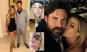 Denise Richards' Shocking Black Eye Sparks Divorce Drama with Aaron Phypers