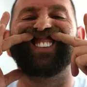 Dental Tourism in Turkey: A Warning from UK Experts After Tragic Death