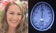 From Menopause Misdiagnosis to Brain Tumour: One Woman's Shocking Health Journey