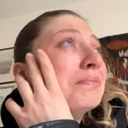 I Have the Same Condition as Vicky Pattison – Here's My Story