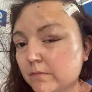 I Was Told My Symptoms Were Just Perimenopause – Then I Got a Shocking Diagnosis