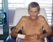 Life-Changing Hepatitis Treatment Offers Hope, Yet Many Still Lack Access – New Report Reveals