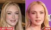 Lindsay Lohan's Shocking Transformation: Has She Gone Too Far with Plastic Surgery?