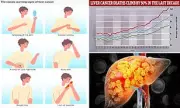 Liver Cancer Cases Skyrocket Among Over-50s: Obesity Crisis to Blame?