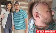 Man's Persistent Headache Leads to Shocking Brain Cancer Diagnosis – The Warning Signs You Should Never Ignore