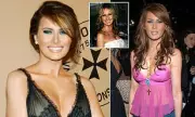 Melania Trump's Plastic Surgery Rumours: Experts Weigh In on Her Changing Appearance