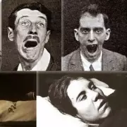 Mystery Illness Strikes: Patients Left Unable to Speak or Walk – What We Know So Far