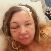 New Glasses Left Me in Agony – My Shocking Experience