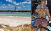 Shark Attack Horror: Surf Instructor Fights Off Predator in Florida