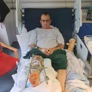 Shocking Farm Accident: Farmer's Leg Looks Like It's 'Bursting Open' After Horror Injury