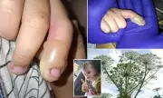 Toddler Hospitalised After Encounter with Toxic Giant Hogweed in Newcastle – What Parents Need to Know