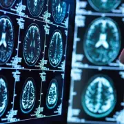 Weight Loss Jabs Could Slash Risk of Heart Attacks and Strokes, New Study Reveals