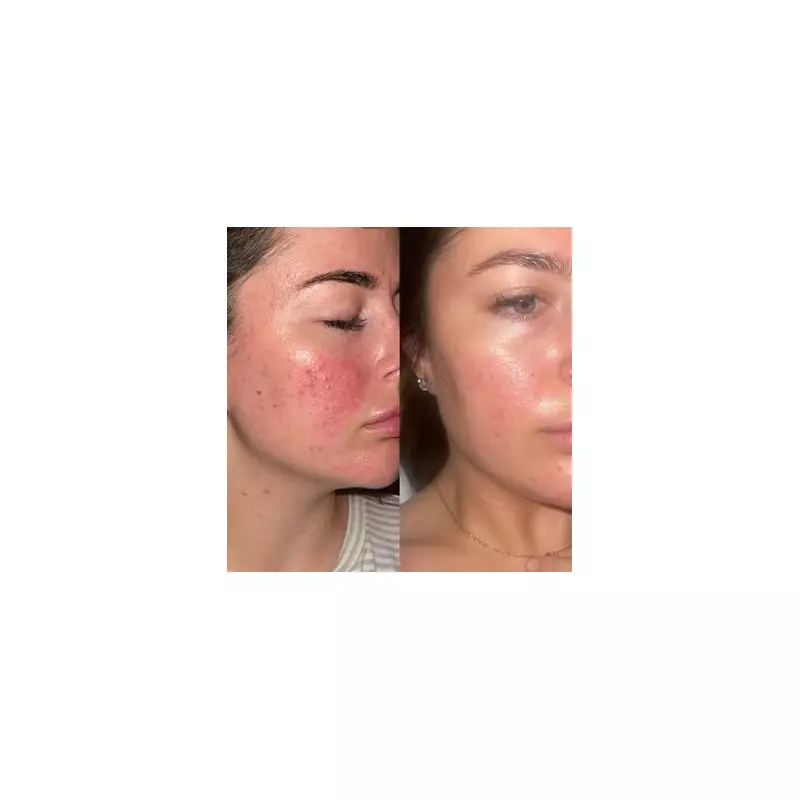 47p Skincare Dupe That Rivals £200 Creams – The Budget Beauty Secret You Need!