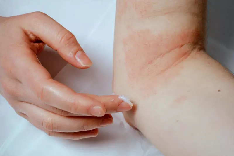 Boots Launches Groundbreaking Psoriasis Clothing Line with Chinese Scrubs