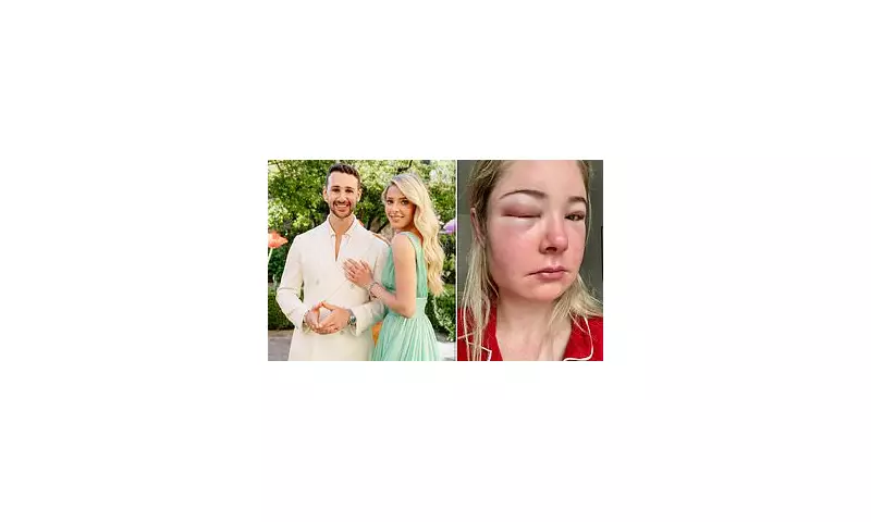 Bride Left Blind in One Eye After Pre-Wedding Beauty Treatment – Urgent Warning Issued