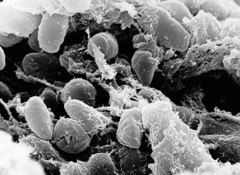 California Plague Case Confirmed Near Lake Tahoe | Health Alert Issued