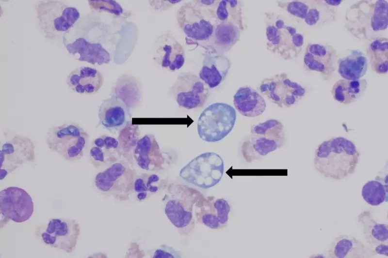 Deadly Brain-Eating Amoeba Claims Life in Missouri Lake: Urgent Health Warning Issued