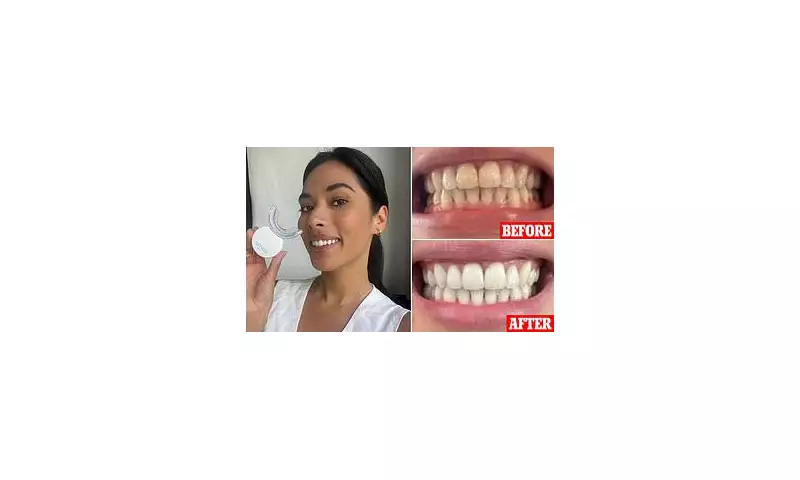 Dentist-Approved Whitening Strips Shoppers Swear By for Brighter Teeth in Just 6 Days