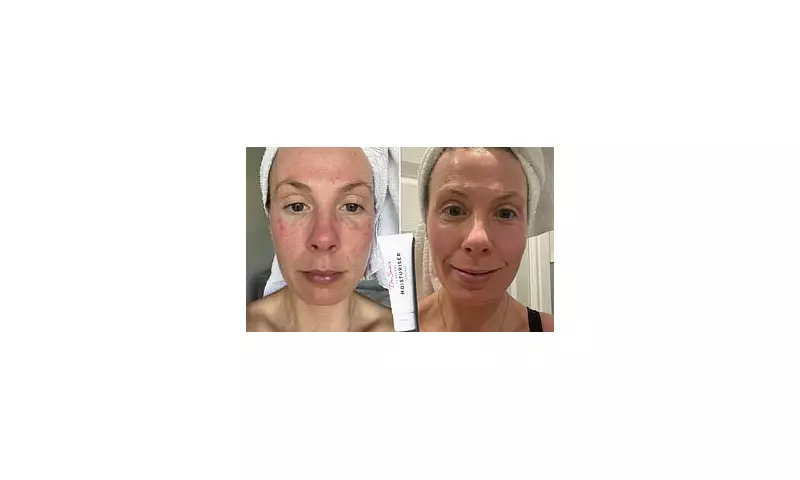 Dermatologists' Secret: This Cult-Favourite Cream Transforms Sensitive Skin Overnight!