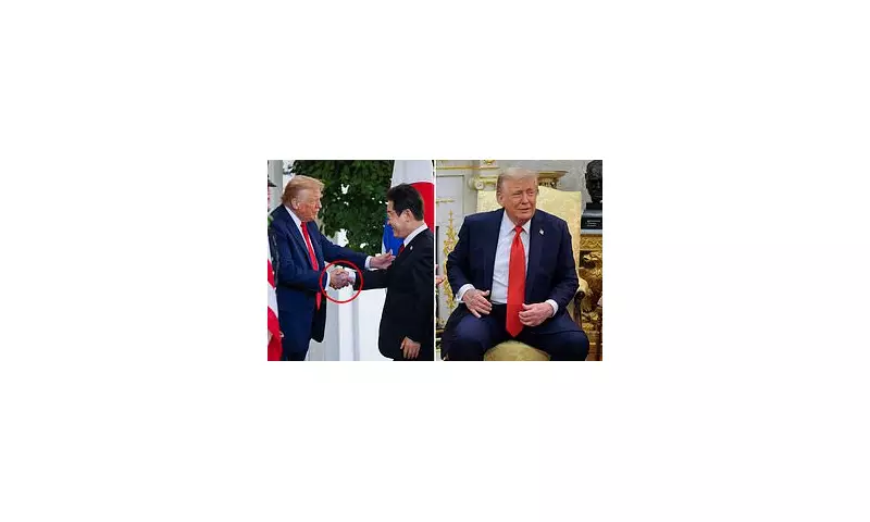 Donald Trump's Bruised Hands Spark Health Worries: Medical Experts Weigh In | Exclusive