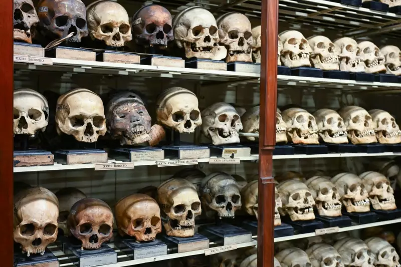 Edinburgh University Confronts Its Past: Racist Skull Collection Used to Justify Empire Exposed