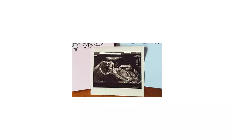 Emmerdale Star Announces Exciting Baby News – Fans Rejoice!