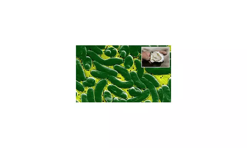 Flesh-Eating Bacteria Outbreak in Louisiana: Two Dead After Consuming Contaminated Seafood | Health Alert